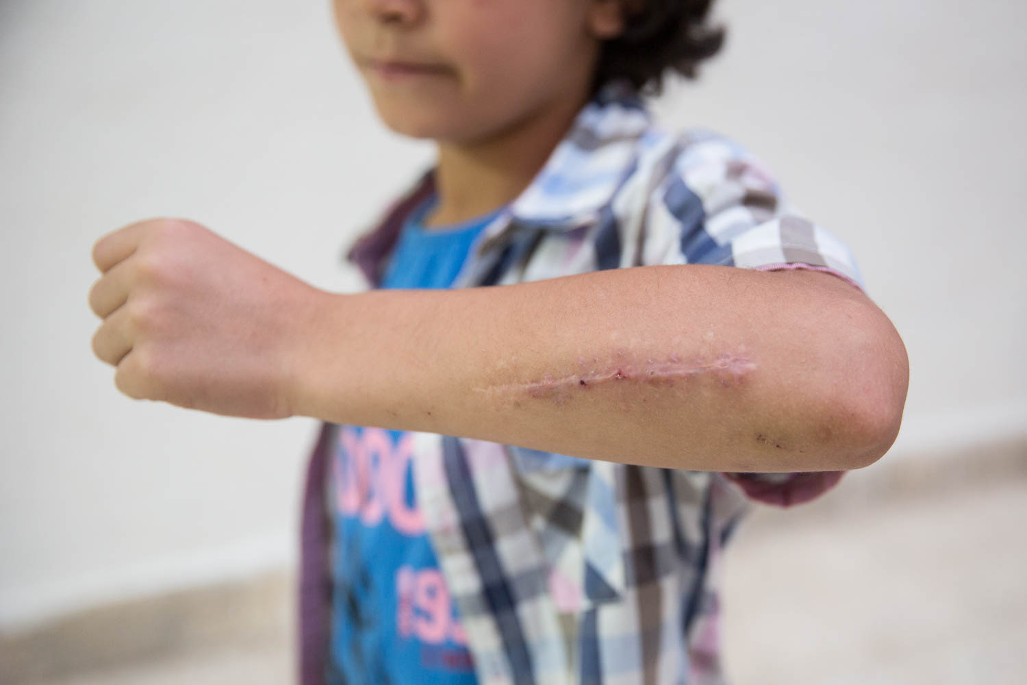  Hasnaaâ€™s children are still struggling to adjust to their new environment. Recently her eldest son had some trouble with other students in the school and returned home with a large wound on his arm. Plan International is supporting remedial classes for Syrian children to follow up lessons and better understand the Egyptian Arabic accent, as well promoting socialisation through sports activities. The safety of her children is Hasnaaâ€™s utmost priority. She dreams of a future in Europe, yet she doesnâ€™t want to risk her children's lives by crossing the Mediterranean Sea. 